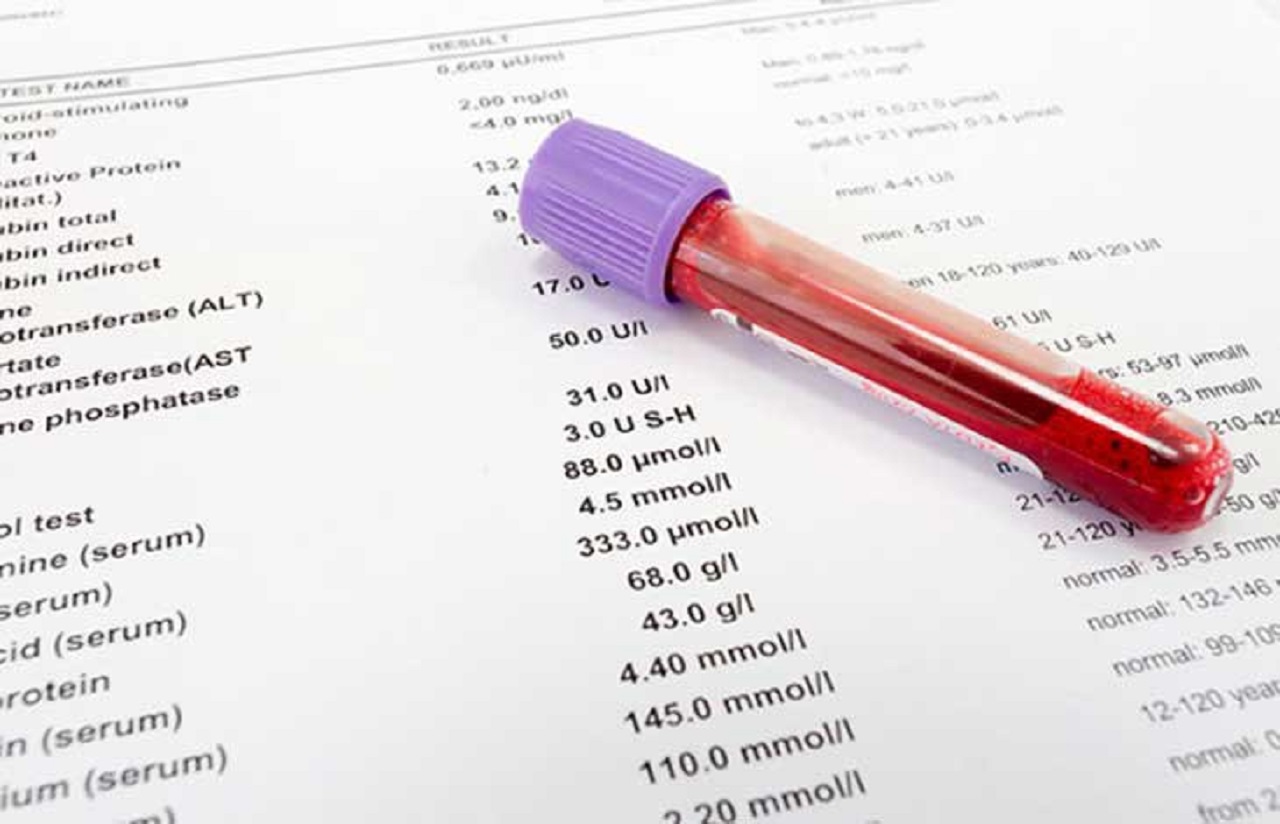 Chỉ số tiểu cầu bao nhiêu là nguy hiểm trong sốt xuất huyết?