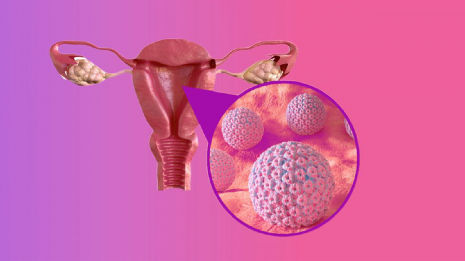 Hình minh họa virus HPV dưới kính hiển vi