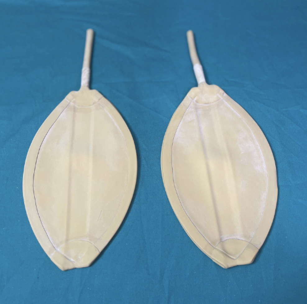 Thổi bóng bay là bài tập tăng sức mạnh cơ thở và làm rỗng khí cặn trong phổi